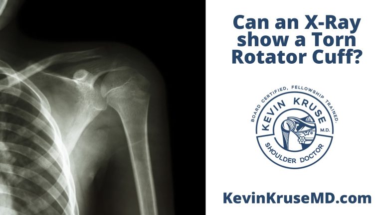 Can X Ray show torn rotator cuff